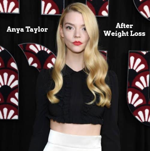anya taylor joy after weight loss photos