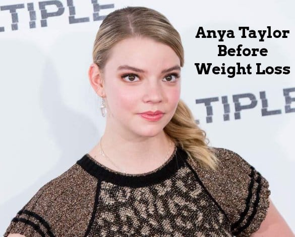 anya taylor joy before weight loss